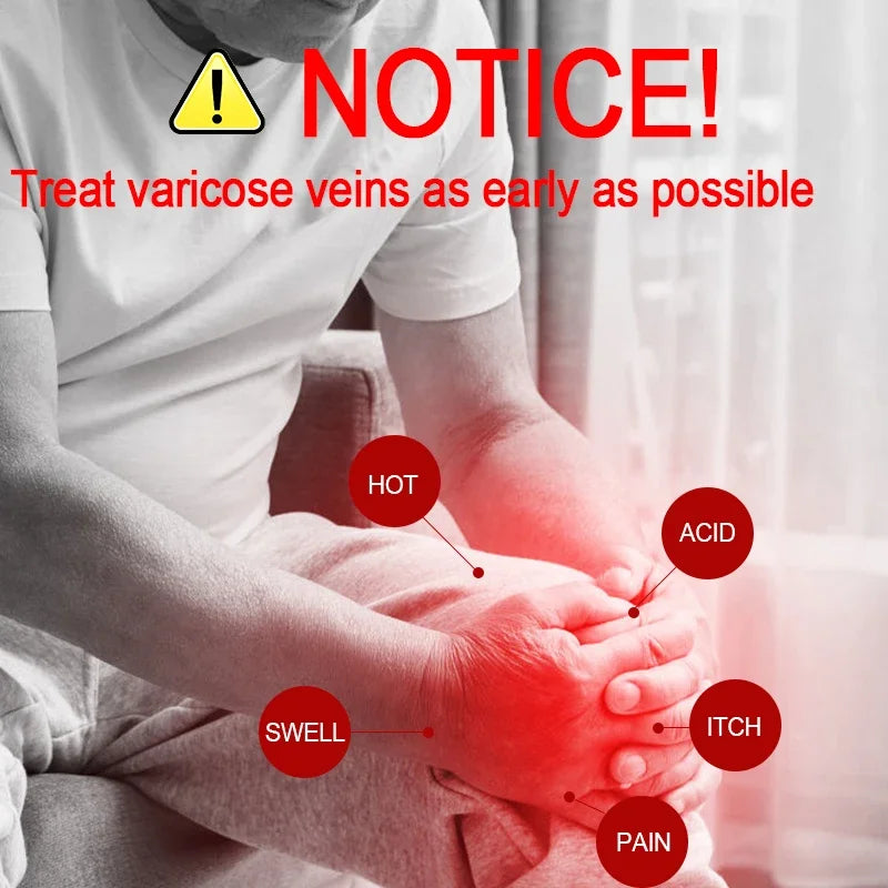 High tech Laser therapy improves moderate varicose veins relieves pain and Improves circulation for men women - Supersell 